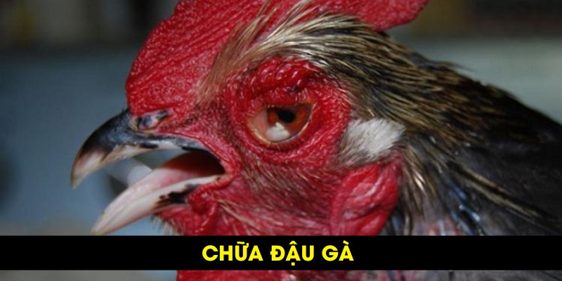 Chữa đậu gà bằng cách gì?